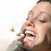 Mouth Openers 10 PCS Set by FAQQI Cheek Retractor for Kids and Adults-3
