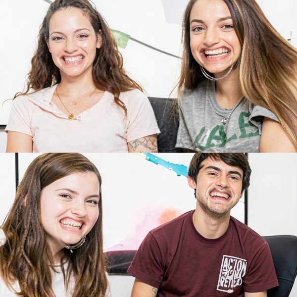 30-Pack Dental Cheek Retractors, Transparent Mouth Opener for Teeth-1